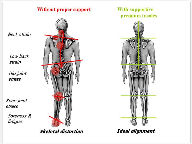 Improved Body Alignment And Balance Superfoot