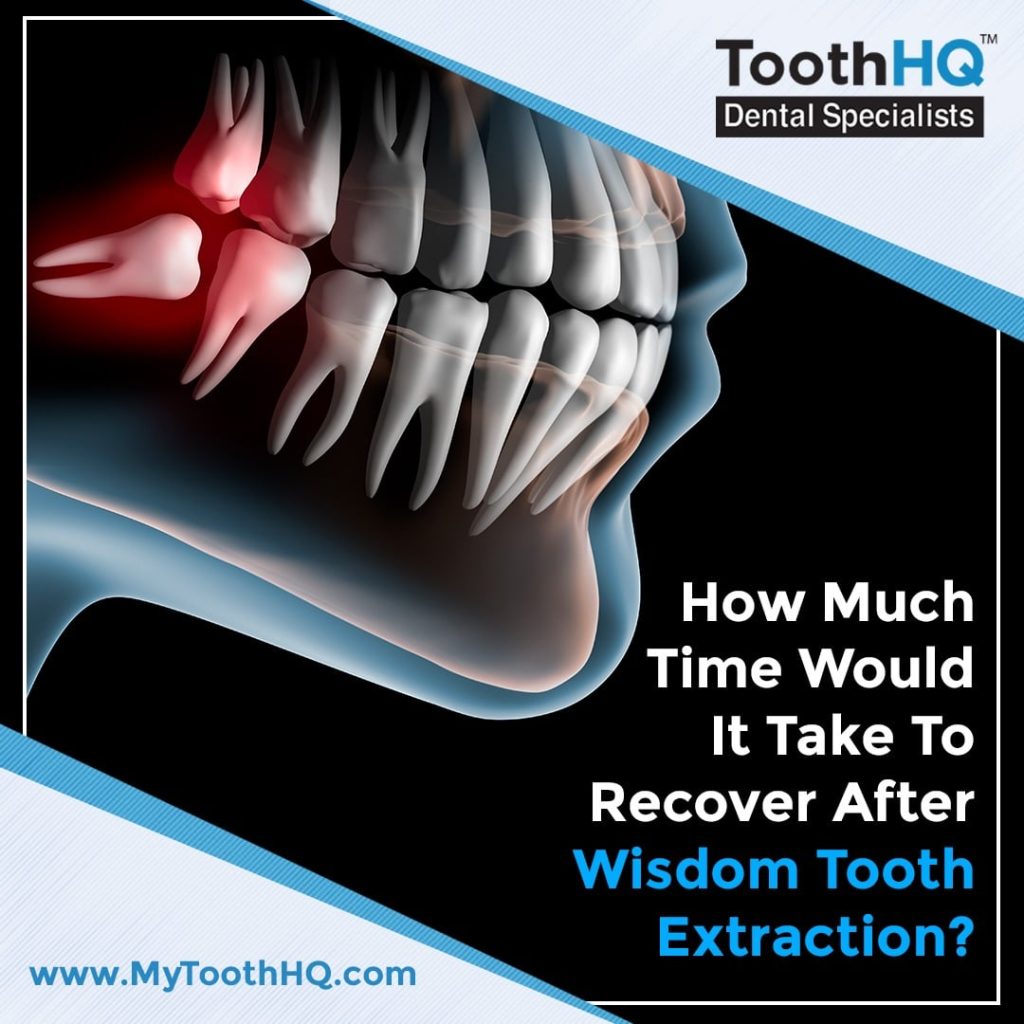 Wisdom Tooth Extraction Archives ToothHQ Dental Specialists