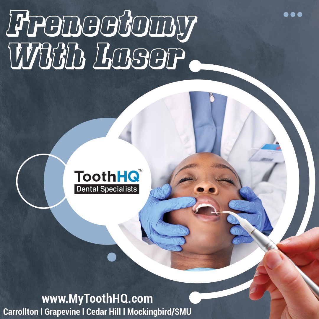 Frenectomy With Laser Dallas Fort Worth Metroplex, Texas ToothHQ