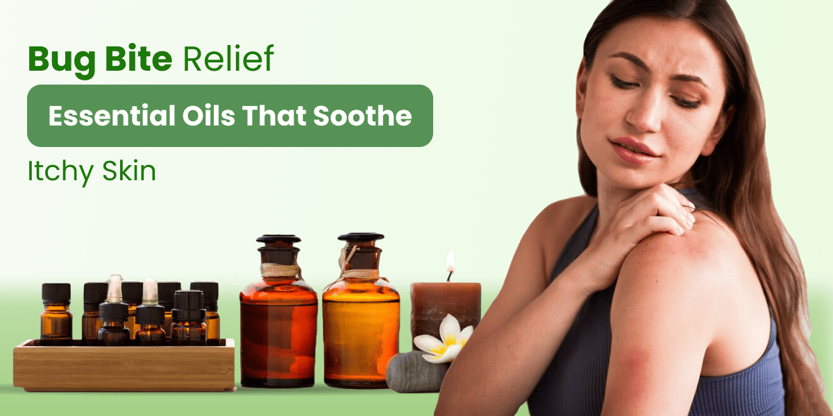 Bug Bite Relief Essential Oils That Soothe Itchy Skin N8