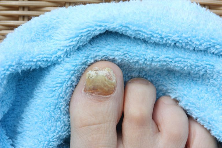 What Are Acrylic Nails And Why You Must Get Them NailDesignCode