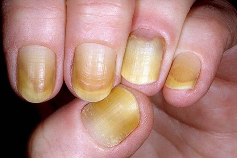 How To Take Care Of Cuticles 7 Steps to Healthy Nails NailDesignCode