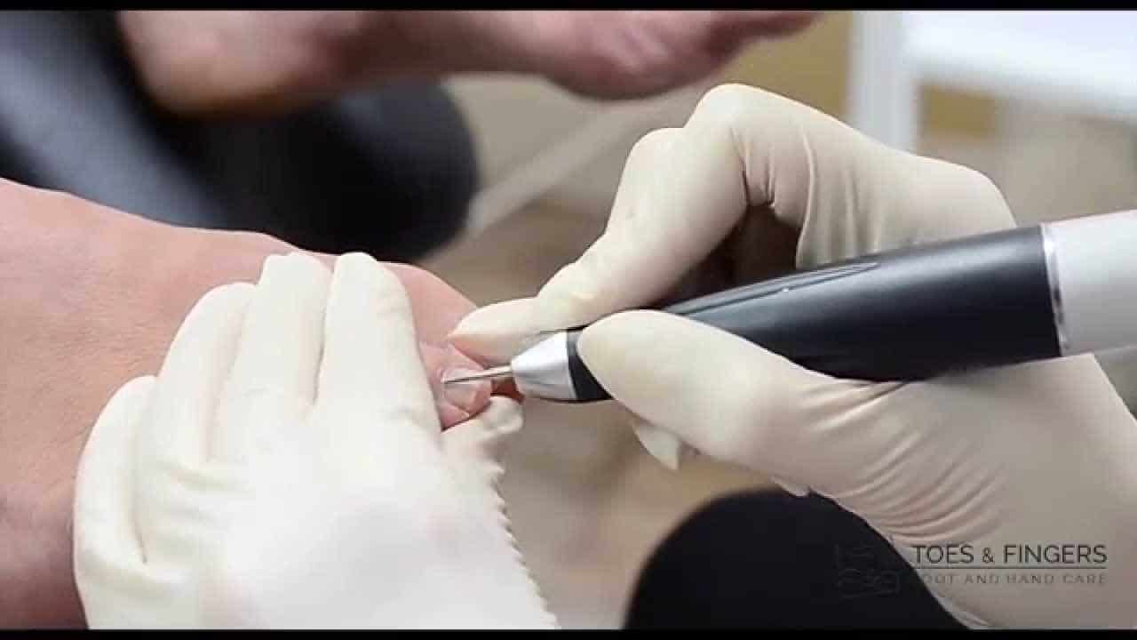 Dry Pedicure Is It Better Than Traditional Pedicure?