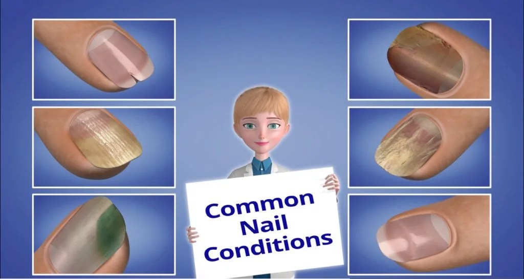Introduction to Nail Conditions NailKnowledge