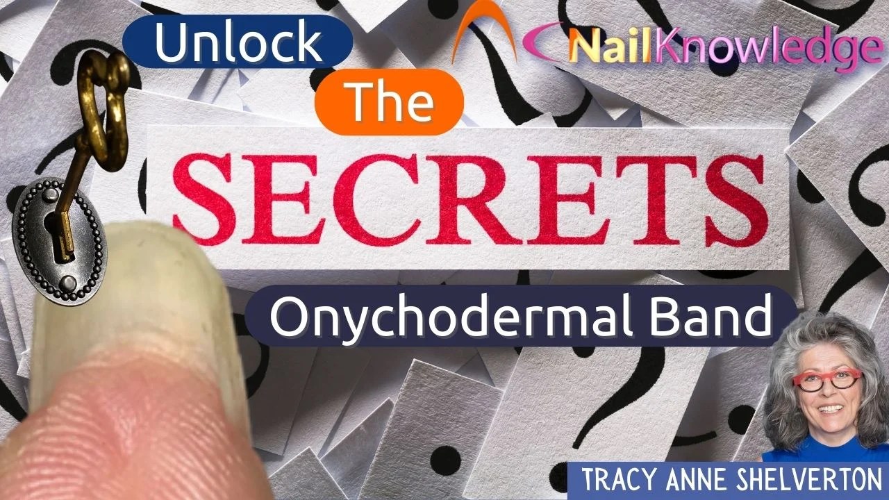 Unlock the Secrets of the Onychodermal Band NailKnowledge(04)