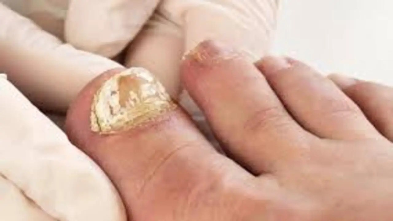 Tips For Preventing Nail Fungus While Using Color Street