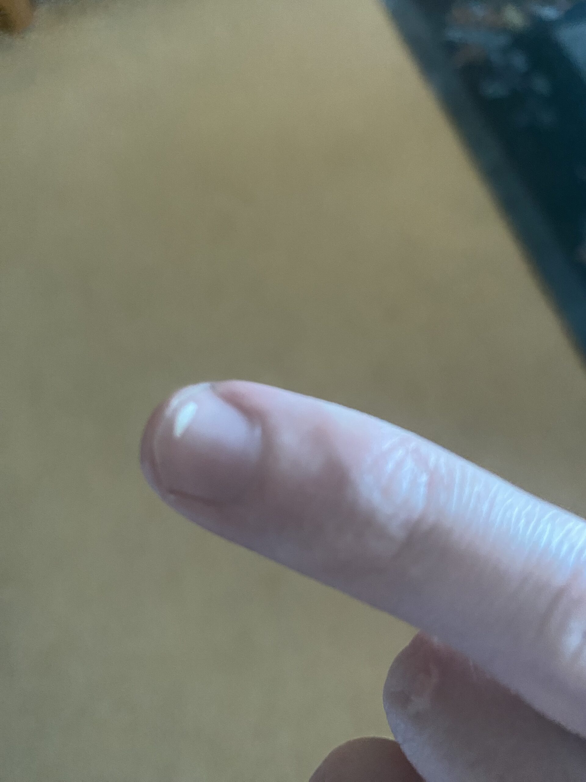 White Spots on Nails Meaning, Causes, and Treatment Nails Nexus