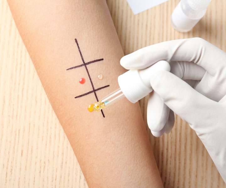 Allergy Testing Food Sensitivity NainaMD Beverly Hills
