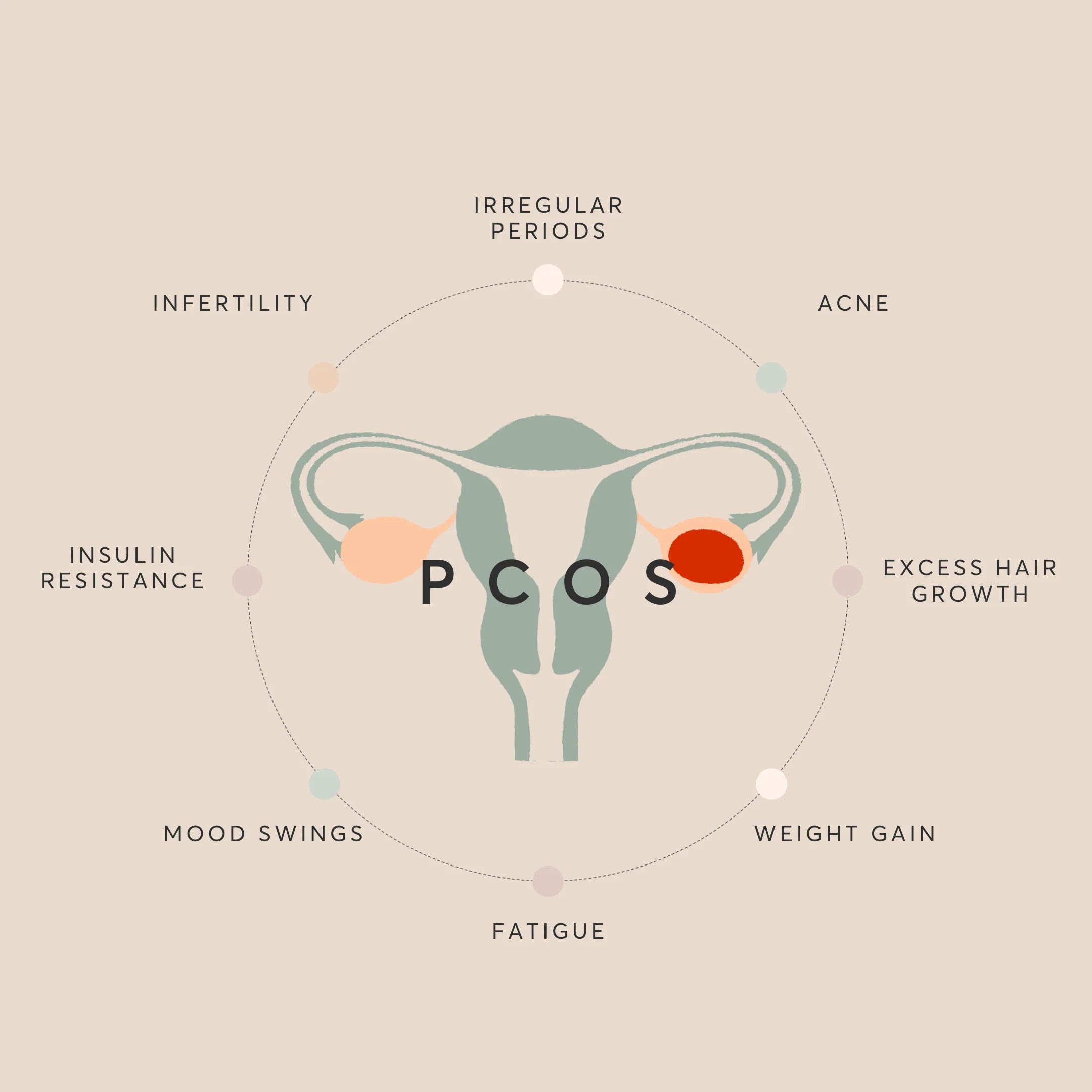Conceiving with PCOS: Lifestyle and Nutrition Advice – Naître