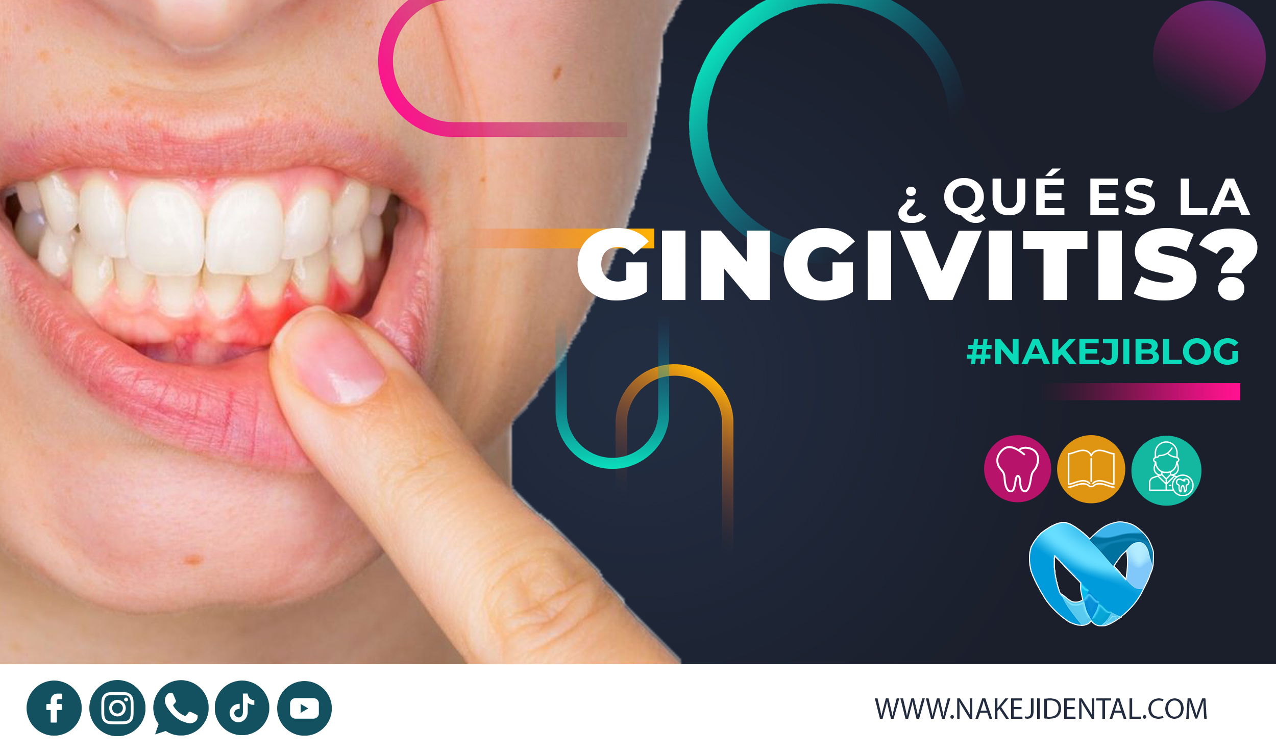 BLOG ¿Qué es la Gingivitis?