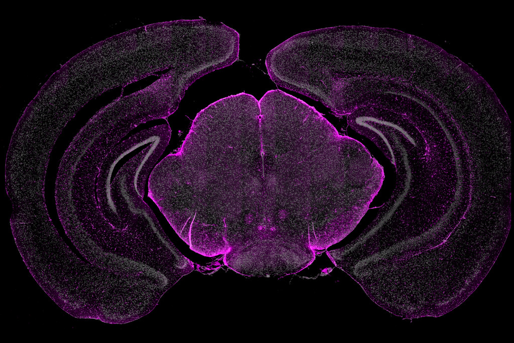 High plex in situ profiling of mouse brain sections with CosMx™ SMI NanoString