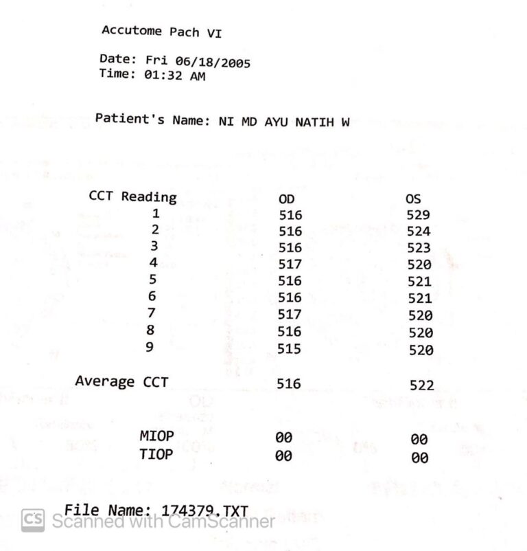 Pengalaman Screening Lasik di RS Mata Bali Mandara