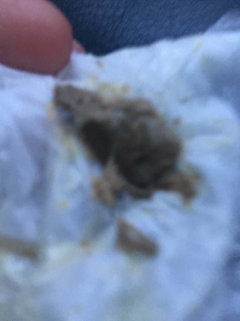 Sinusitis Successes Natural Harmony Clinic