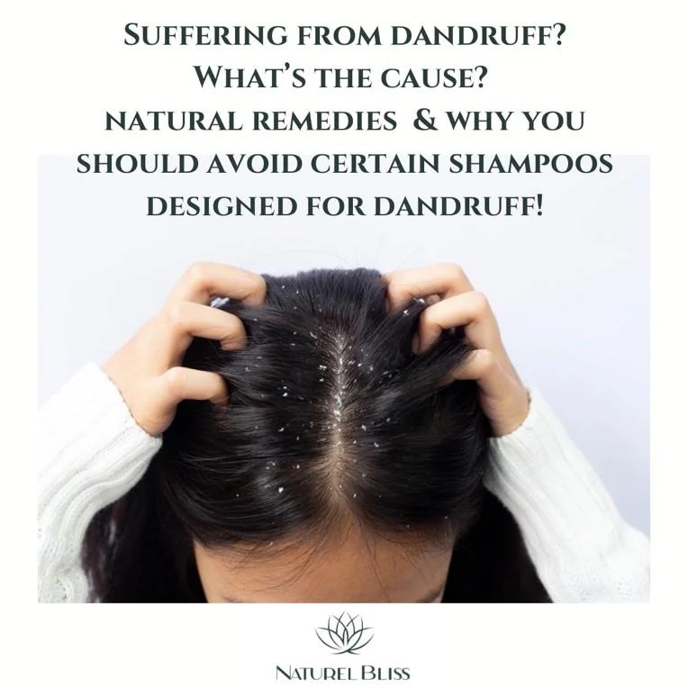 Suffering From Dandruff? What Is The Cause? Natural Remedies And Why
