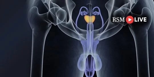 Imaging and prostate cancer Diagnosis, treatment and monitoring and