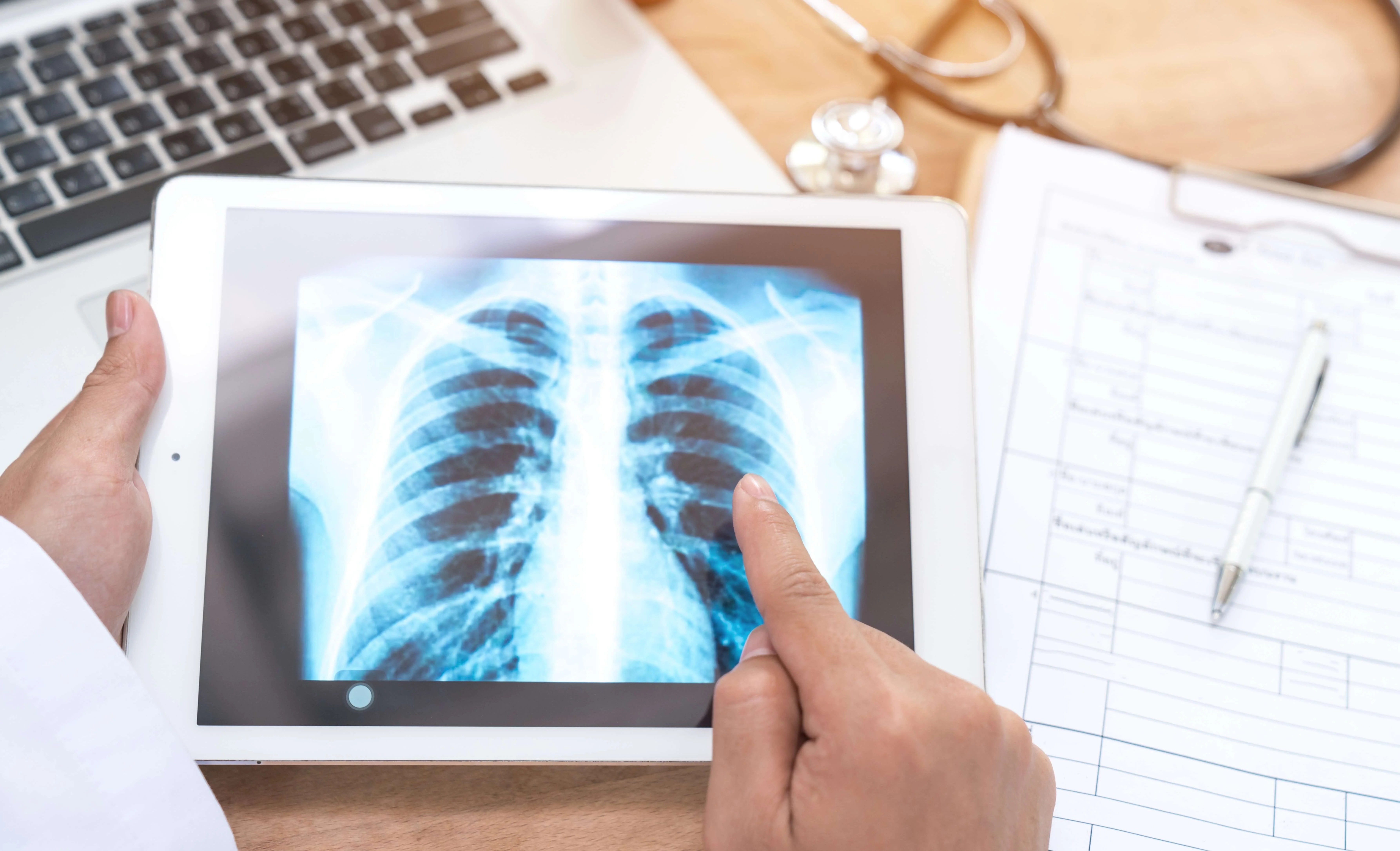 About Lung Screen Registry