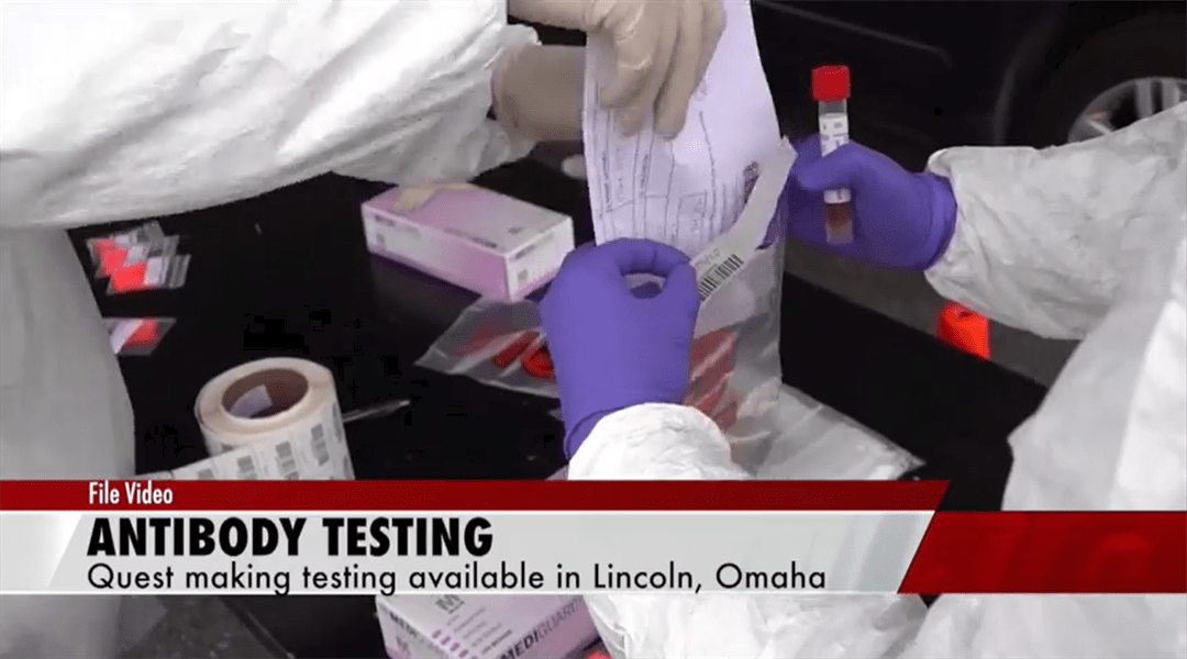 COVID19 antibody tests available in Lincoln NEWS CHANNEL NEBRASKA
