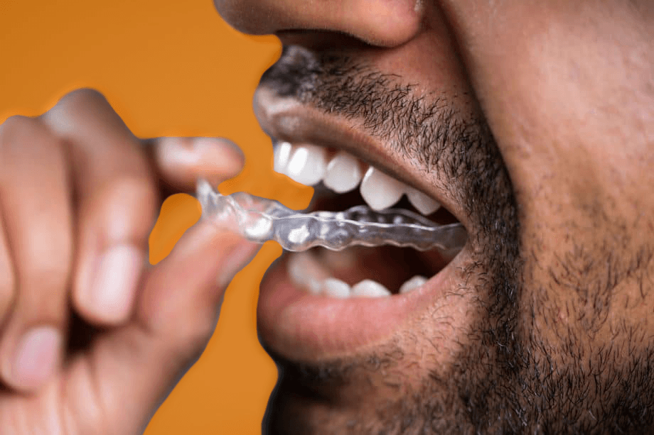 A Quick Guide to Retainer Maintenance NCOSO NC Orthodontist