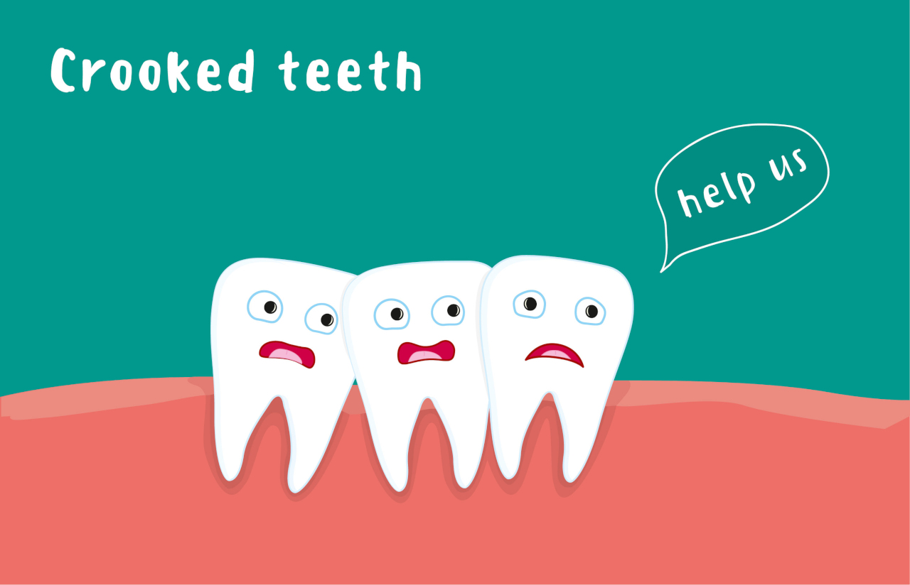 How To Fix Crooked Teeth North DeKalb Orthodontics