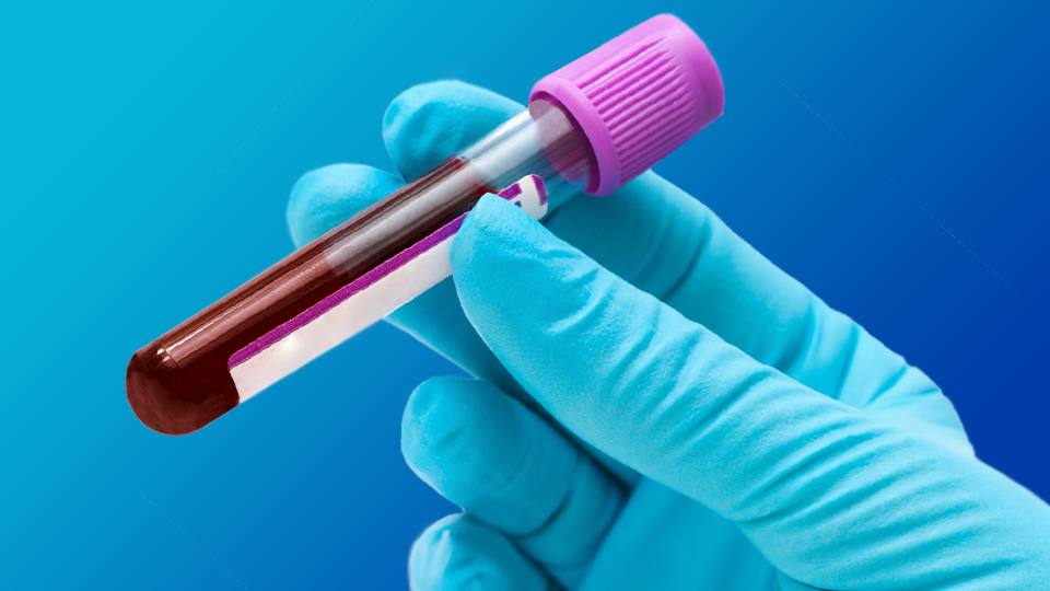 CDP Blood Lab passes annual compliance inspection NDPC National