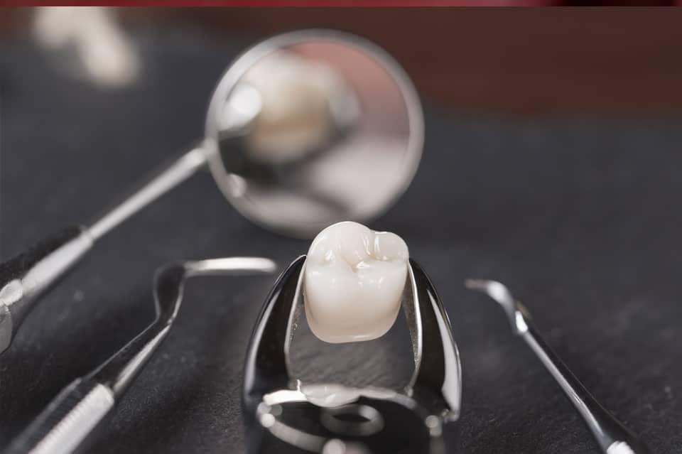 Dental Crowns Near Me Porcelain dental crown procedure