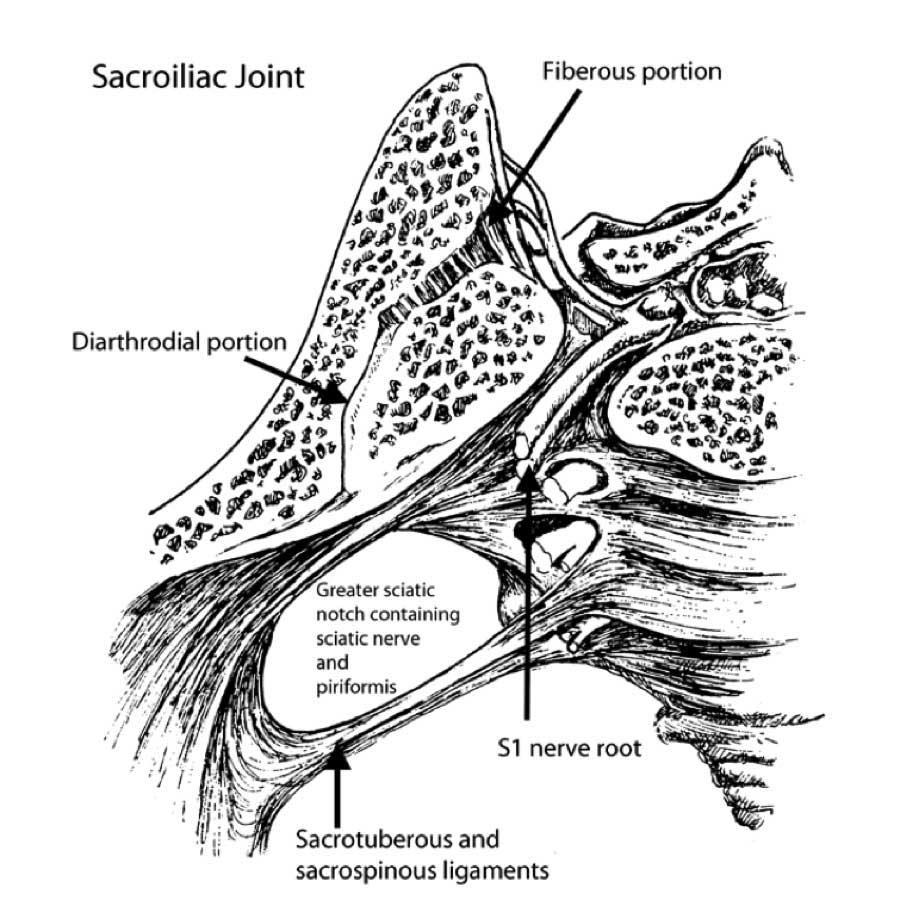 Sacroiliac Joint Pain Syndrome SI Joint Pain Vail, Aspen, Denver CO