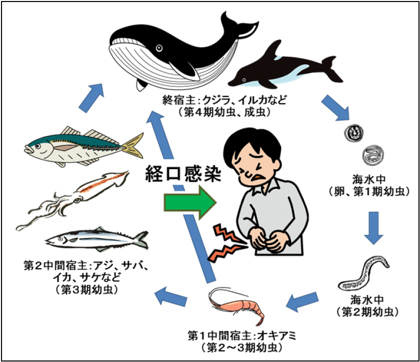 アニサキス症の原因