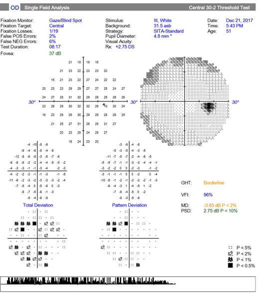 Visual Field's Instagram, Twitter & Facebook on IDCrawl