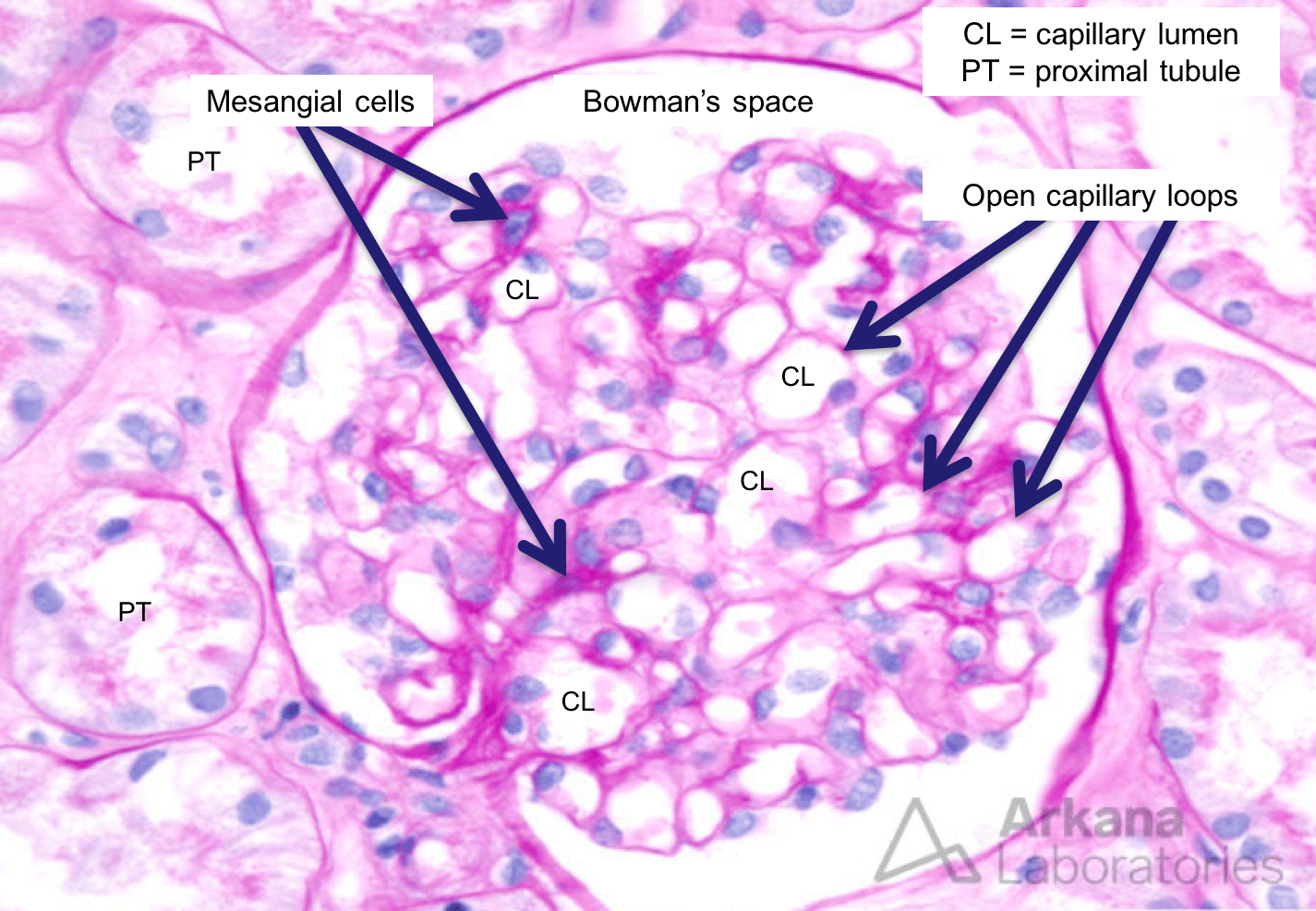 Normal Glomerulus Histology