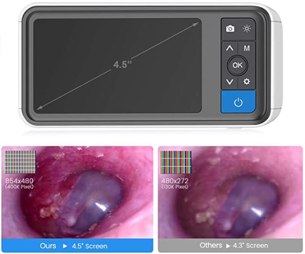 Best Digital Otoscope Camera for Ear Wax Removal (2023 Updated)