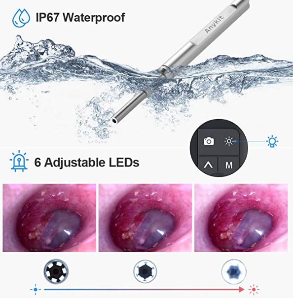 Best Digital Otoscope Camera for Ear Wax Removal (2023 Updated)