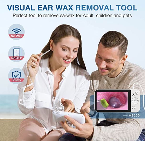 Best Digital Otoscope Camera for Ear Wax Removal (2023 Updated)