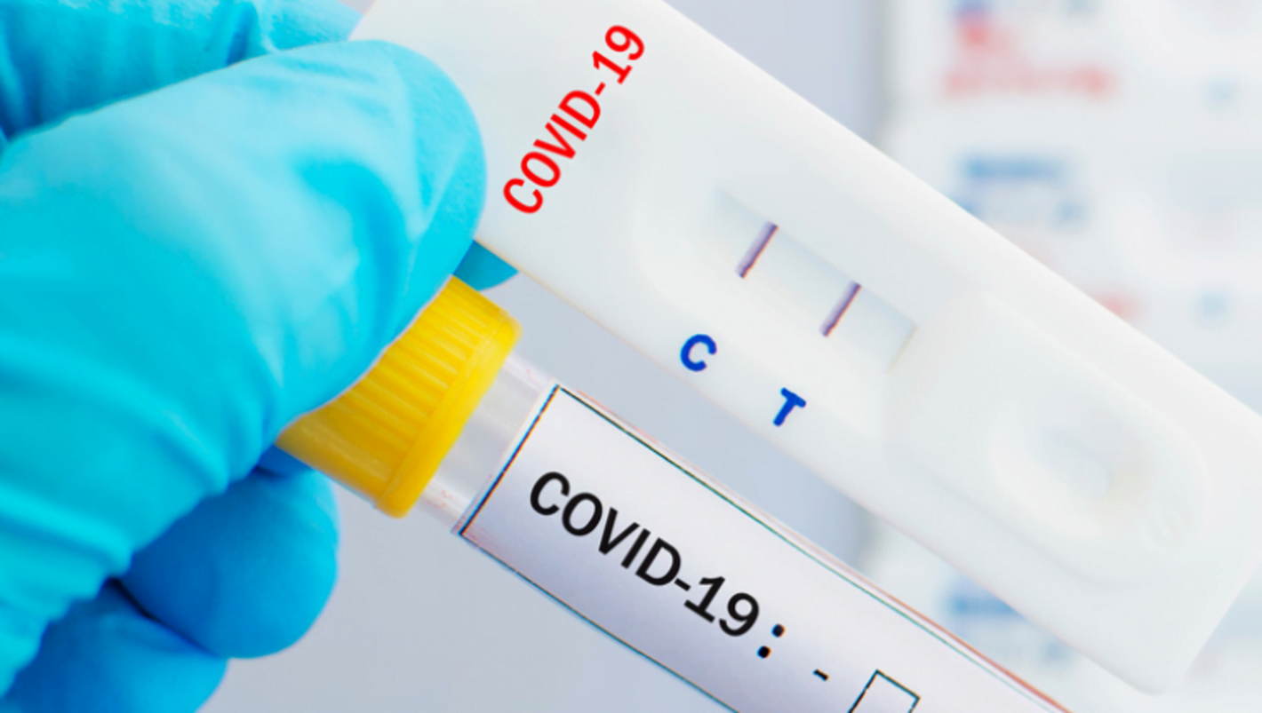 COVID TESTS (PCR / ANTIGEN / LFT) IRELAND TRAVEL. Doctor / Läkare