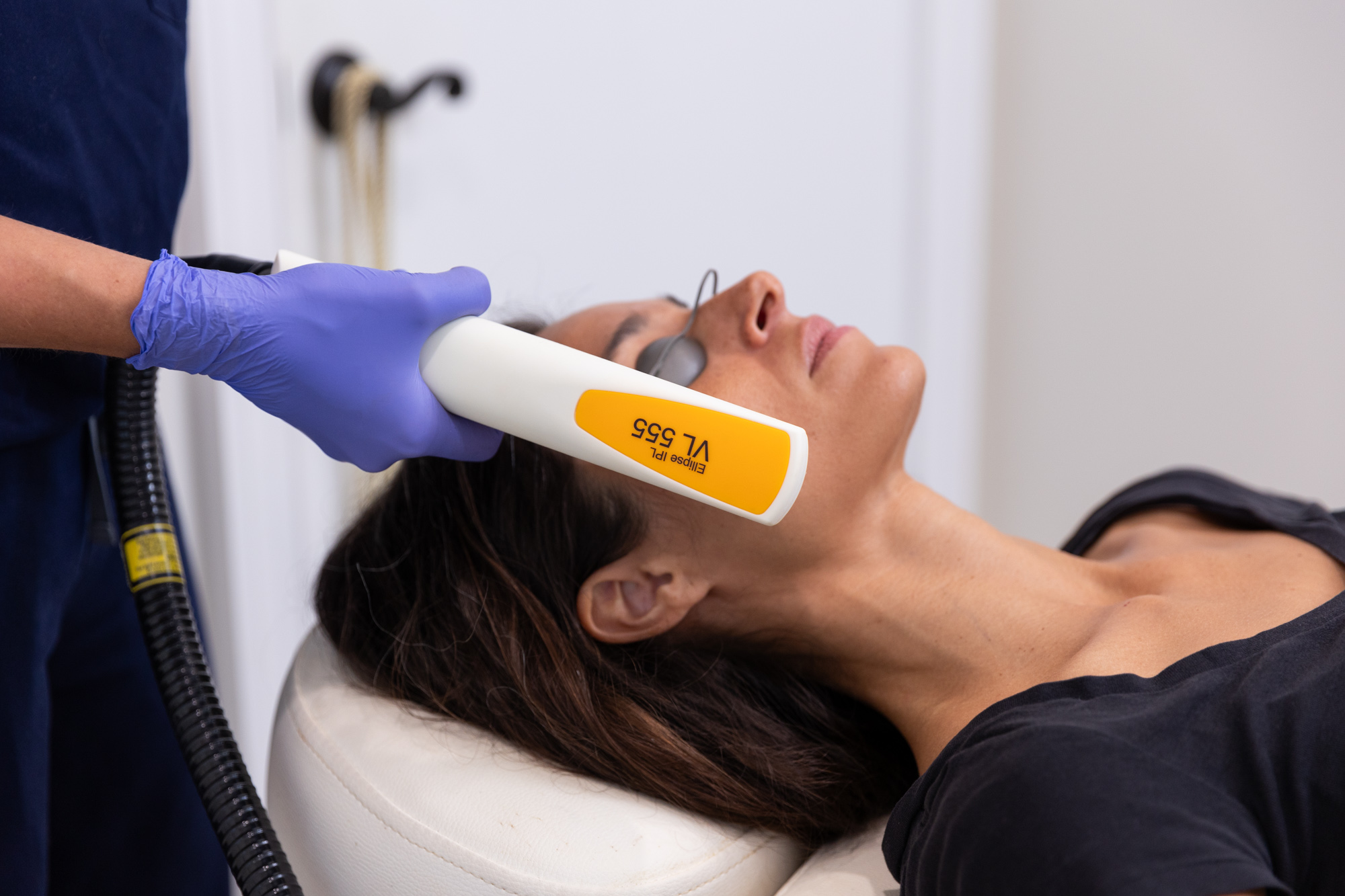 IPL Photofacial in Charlottesville Neroli Med Spa & Beauty Lounge