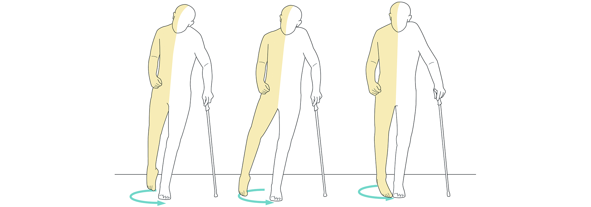 Foot Drop Nerveaide Rehabilitation Systems