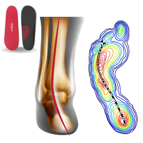Custom Orthotics For Supination Netstep