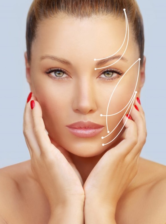 Thread Lift I PDO Thread Lift I MEDiTHREAD Lift I San Diego I Neu Look