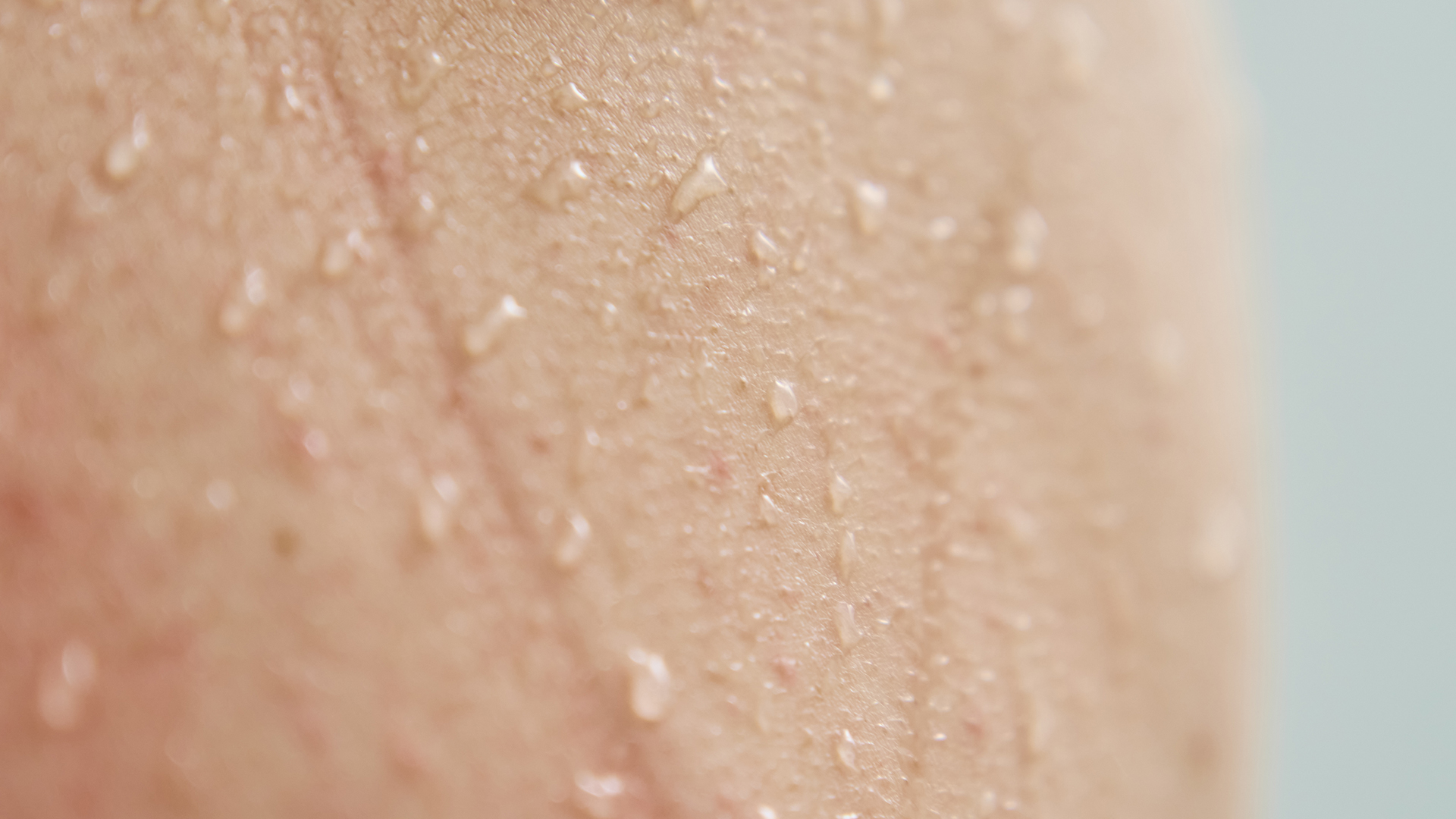 Hyperhidrosis Treatment Breakthroughs Neumark Surgery