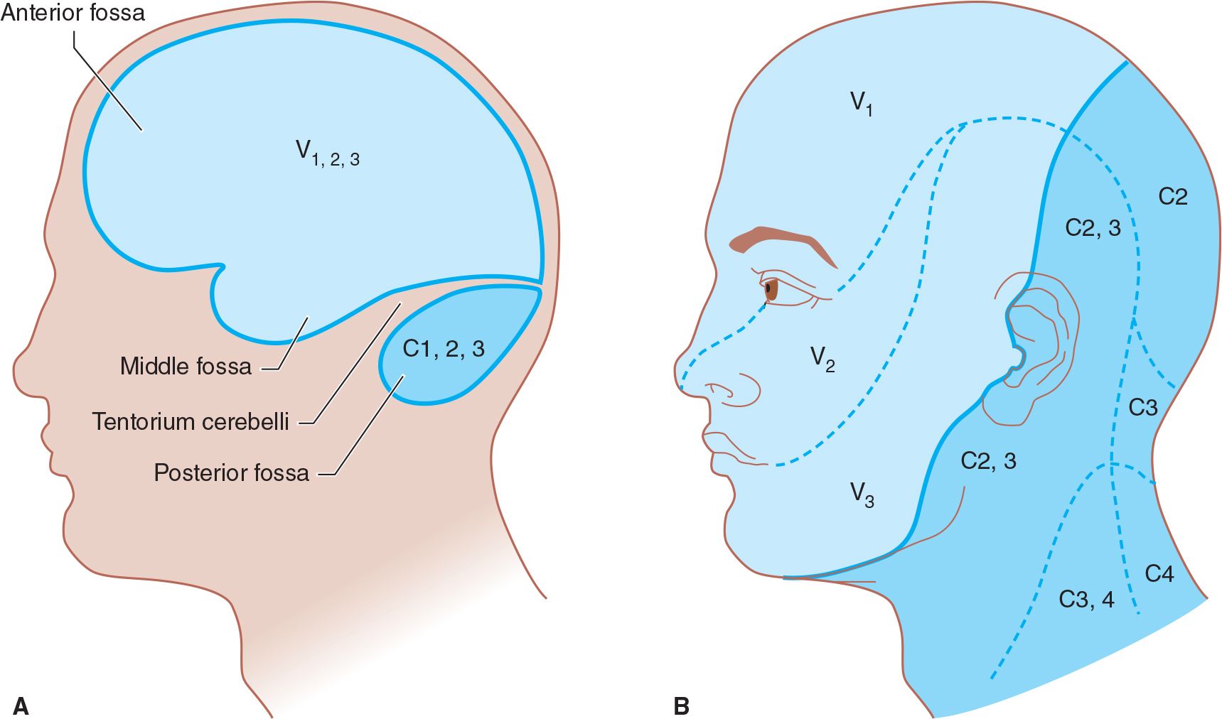 Headache & Facial Pain Neupsy Key