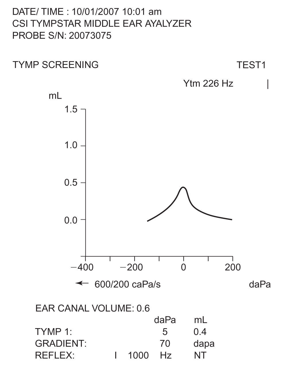 Approach to the Patient with Hearing Loss Neupsy Key
