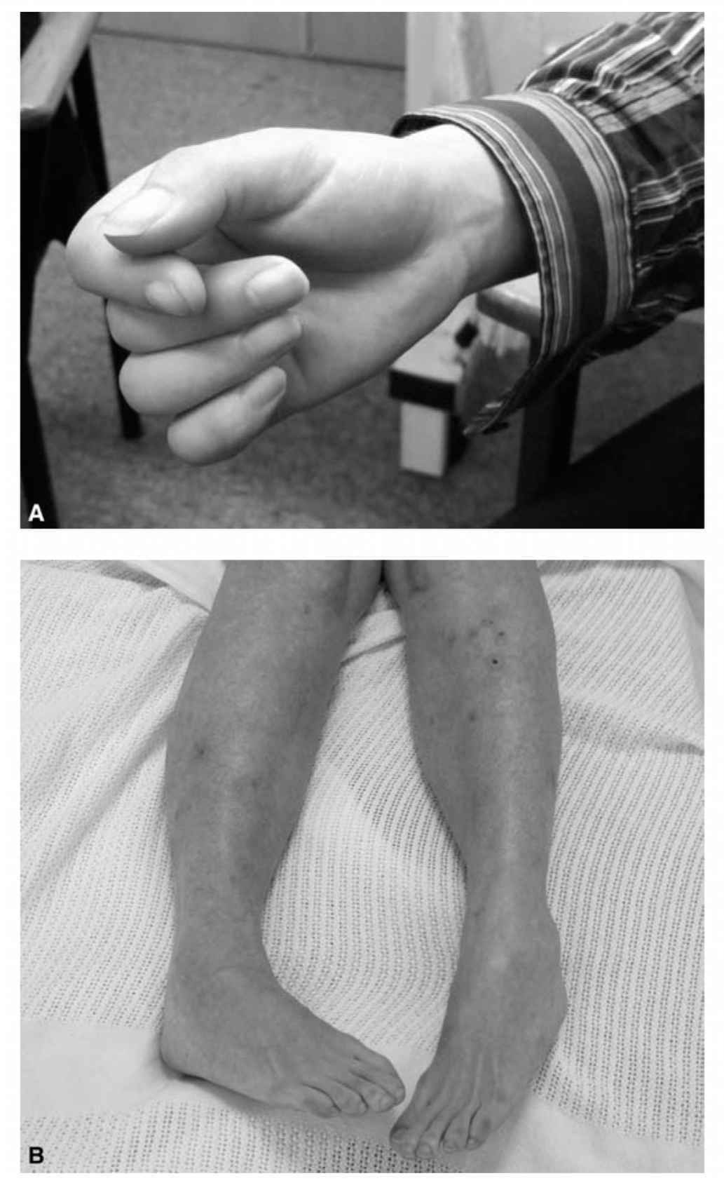 Approach to the Patient with Functional Disorders in the Neurology