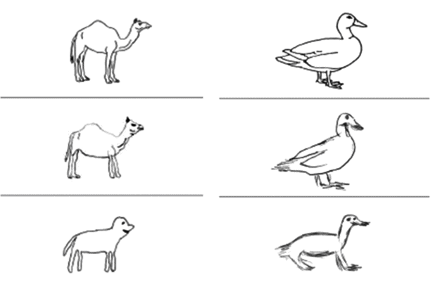 Semantic dementia (semantic variant primary progressive aphasia