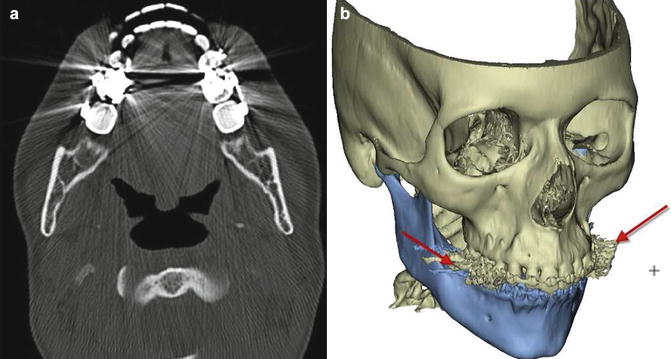 Post-processing of DICOM Images | Neupsy Key