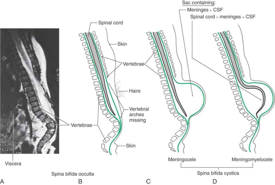 Development of the Nervous System Neupsy Key