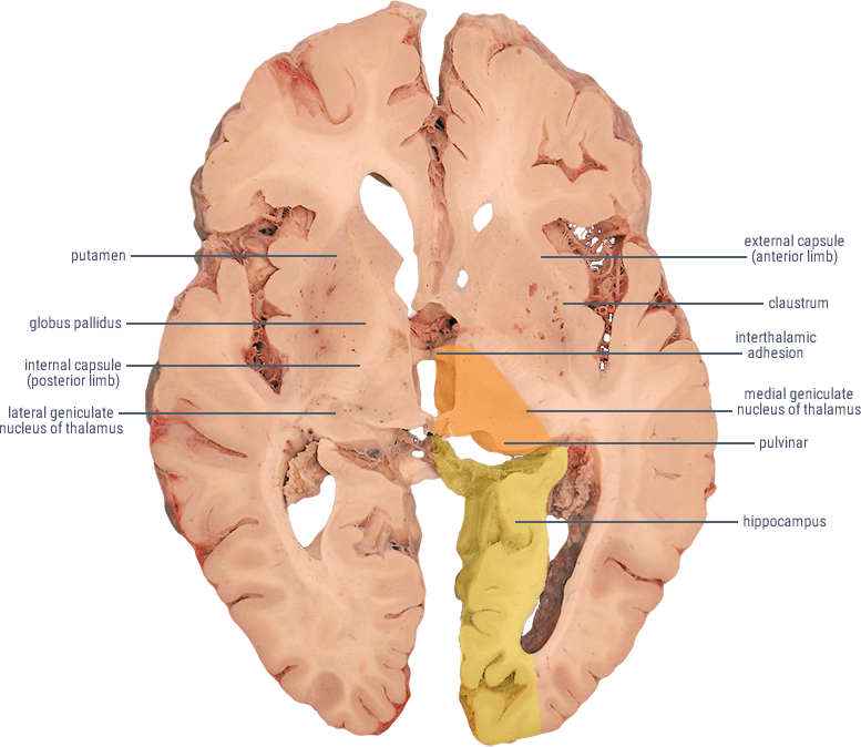 Posterior Cerebral Artery