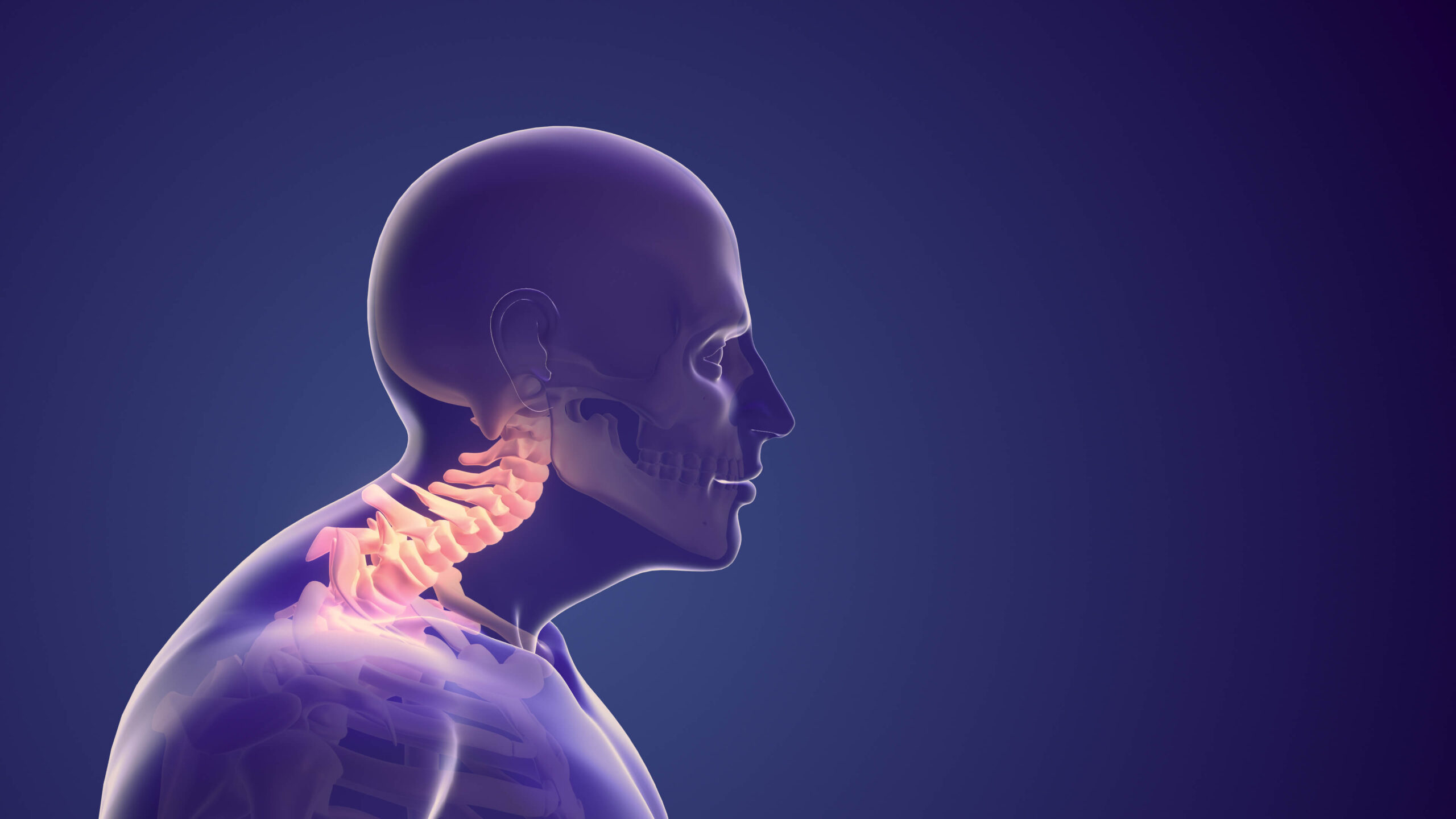 Forward Head Posture Neurosurgery & Spine Consultants