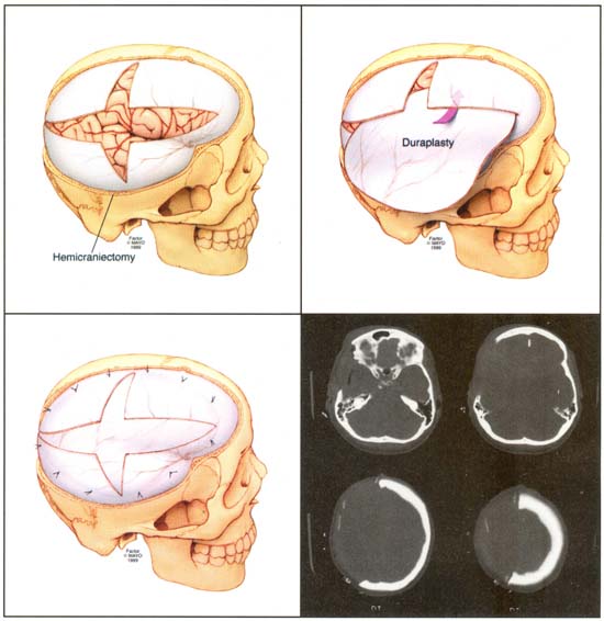 neurocriticalcare / FrontPage