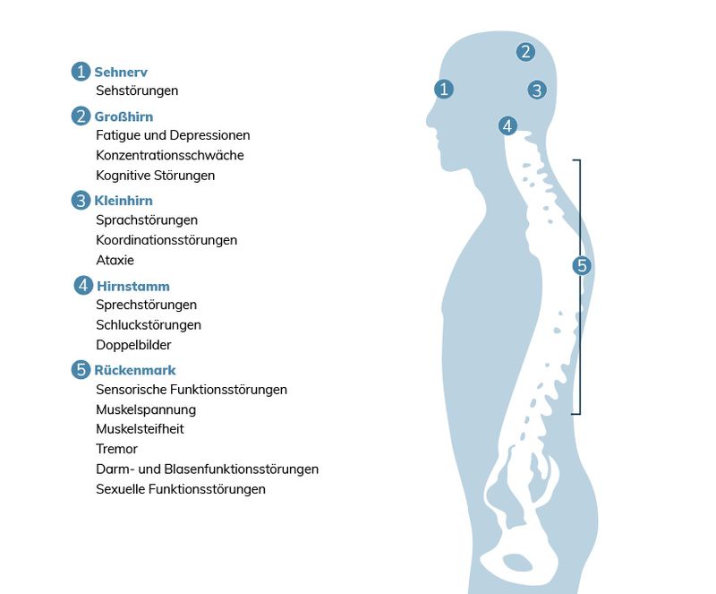 MSSymptome viele Anzeichen der Krankheit neuronurses.de