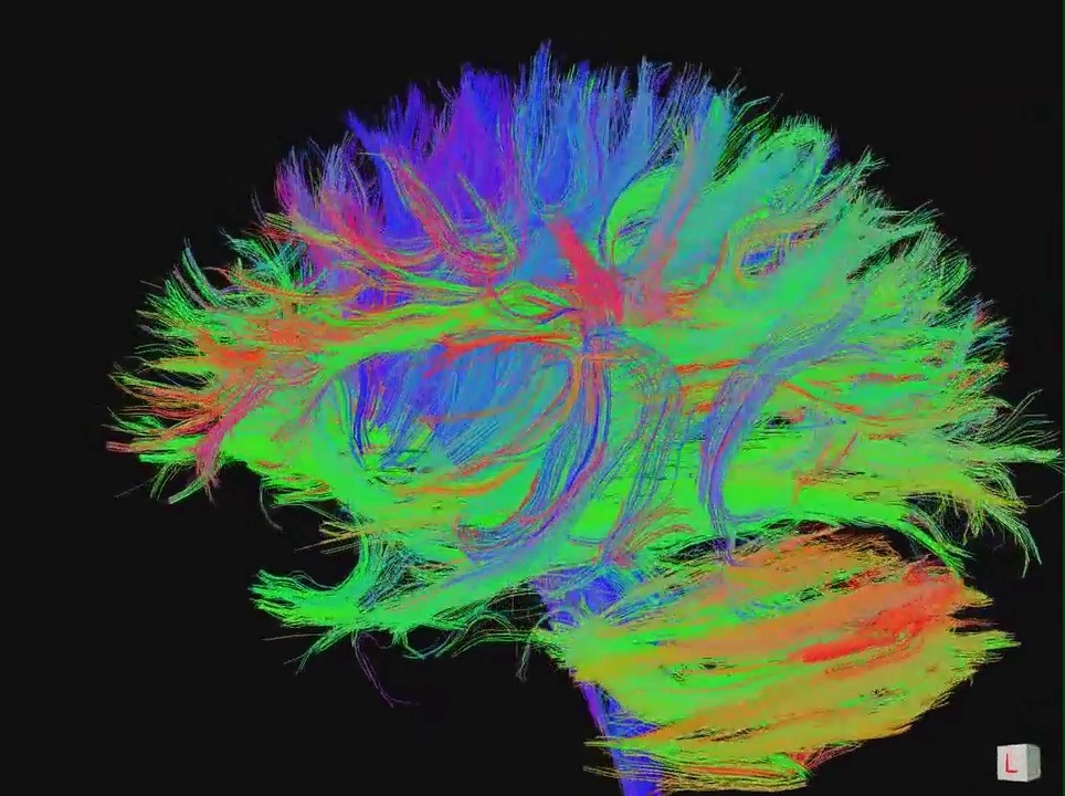 Neuroplasticity Archives The Neuroscience School