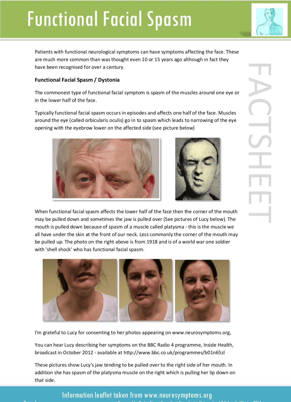 Functional Facial Symptoms Functional Neurological Disorder (FND)